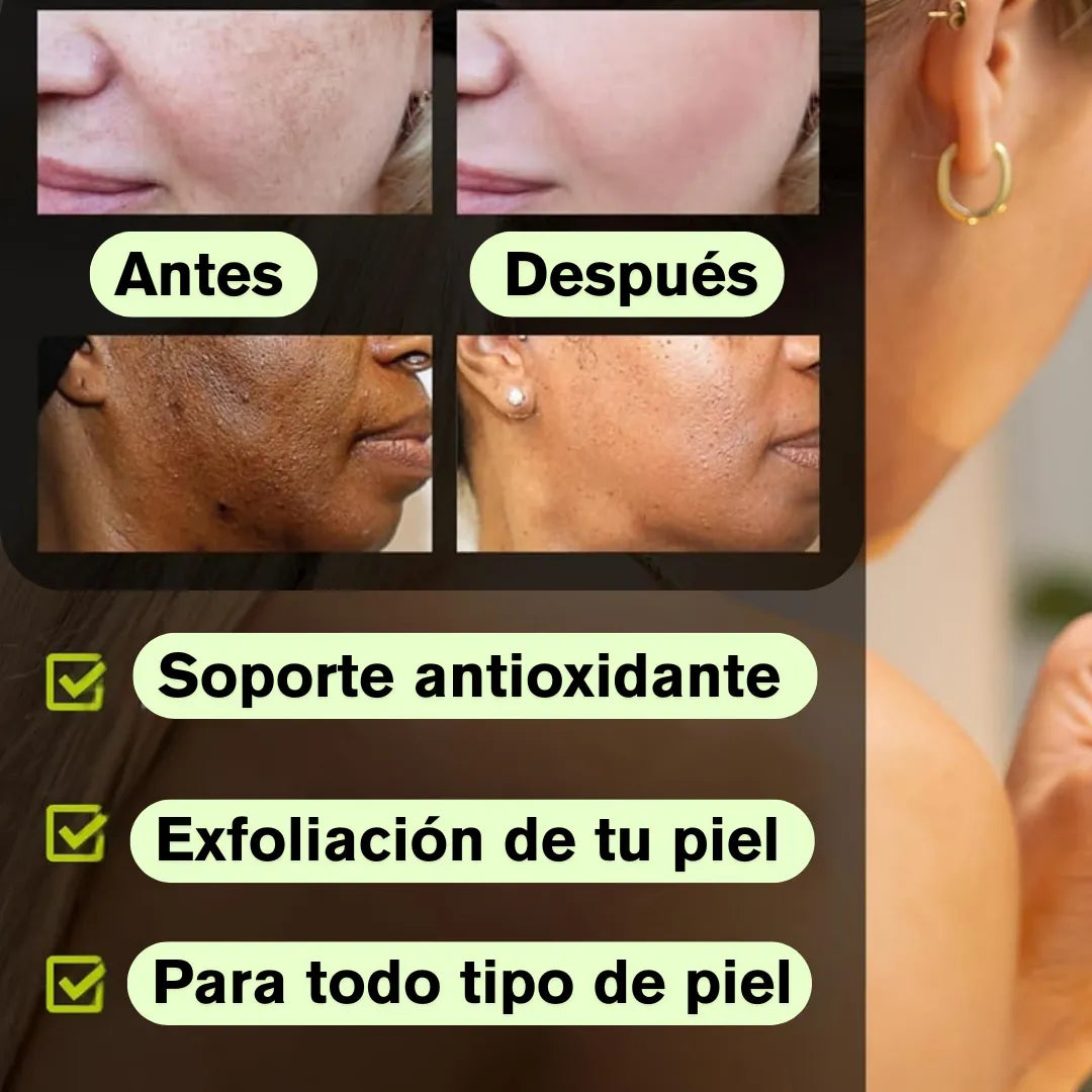 Jabón Iluminador Con Ácido Kójico